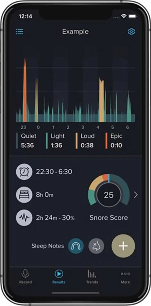 iphonexs-results-phkxyqow9wyohp3d75lymaxy8ianvi9kdfhyhb0prk